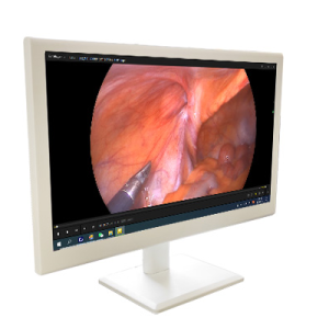 MONITOR FULL HD